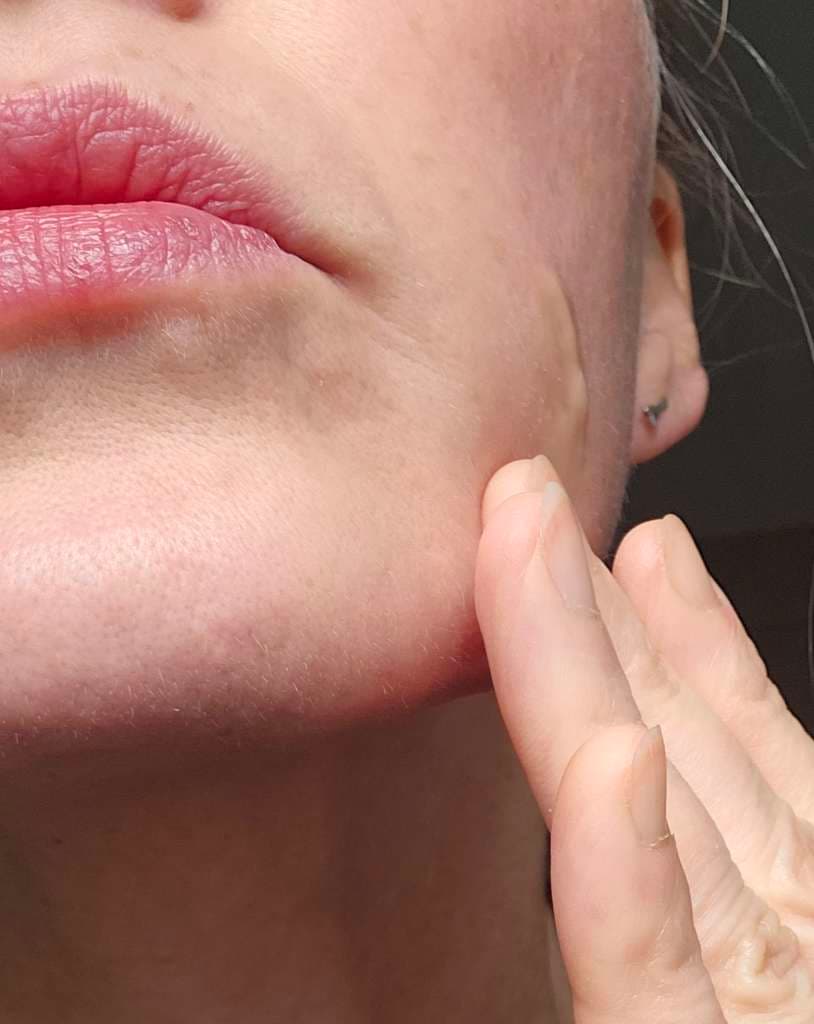 Multi purpose Moisturising Apple Cider Vinegar Gel